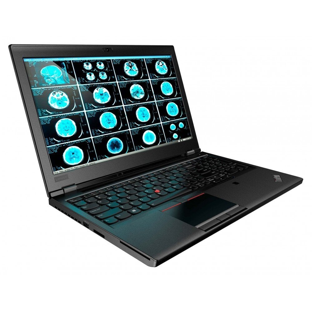 Lenovo ThinkPad P52| Intel Core i7-8850H (6C/12T, 2.6-4.3 GHz, 9MB)| Quadro P2000 4GB | 32 GB DDR4| 256GB SSD M.2 PCIe + 1TB HDD|15.6" (396mm) FHD (1920x1080), anti-glare, LED backlight, WVA, 300 nits|Windows 11 Pro| Uuendatud/Renew hind ja info | Sülearvutid | hansapost.ee