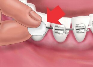 Vaha peegliga Ortho (spetsiaalselt ortodontiliste seadmete kasutajatele) G.U.M.® (723) hind ja info | Hambaharjad, hampapastad ja suuloputusvedelikud | hansapost.ee