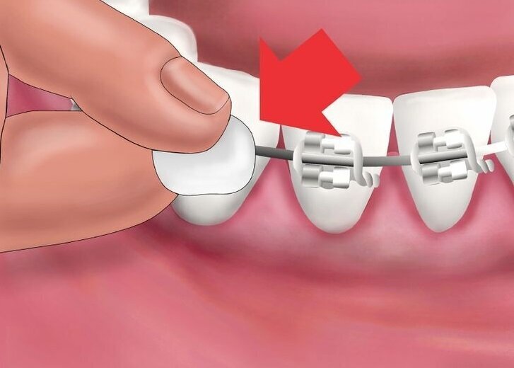 Vaha peegliga Ortho (spetsiaalselt ortodontiliste seadmete kasutajatele) G.U.M.® (723) цена и информация | Hambaharjad, hampapastad ja suuloputusvedelikud | hansapost.ee